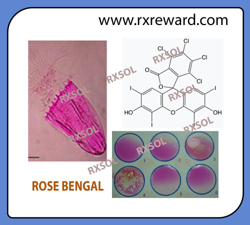 ROSE BENGAL